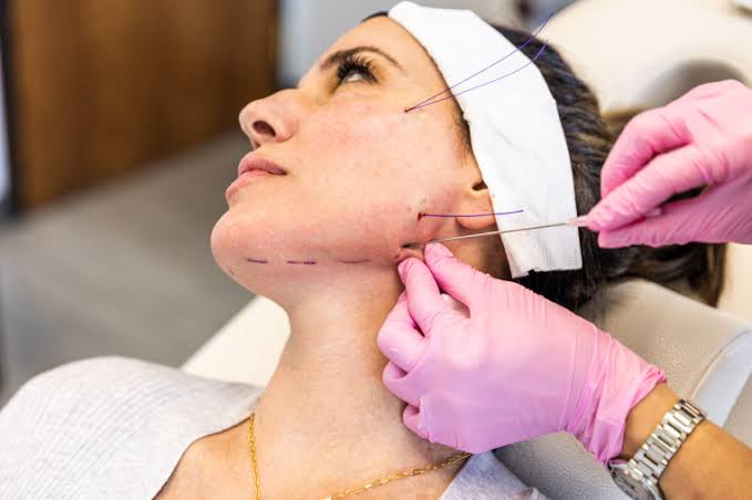 Facial treatment