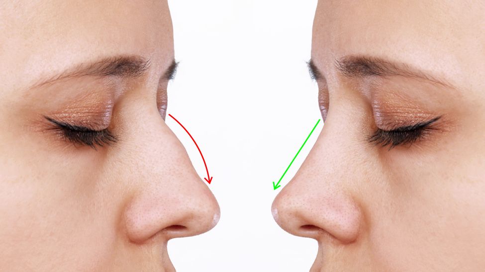 Facial treatment