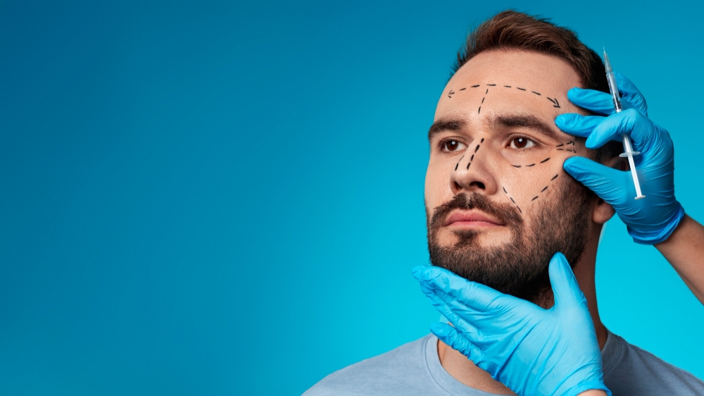 Facelift