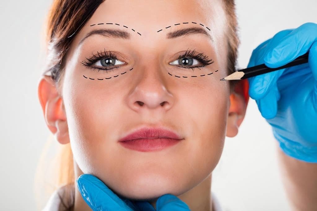 Eyelid Surgery (Blepharoplasty)
