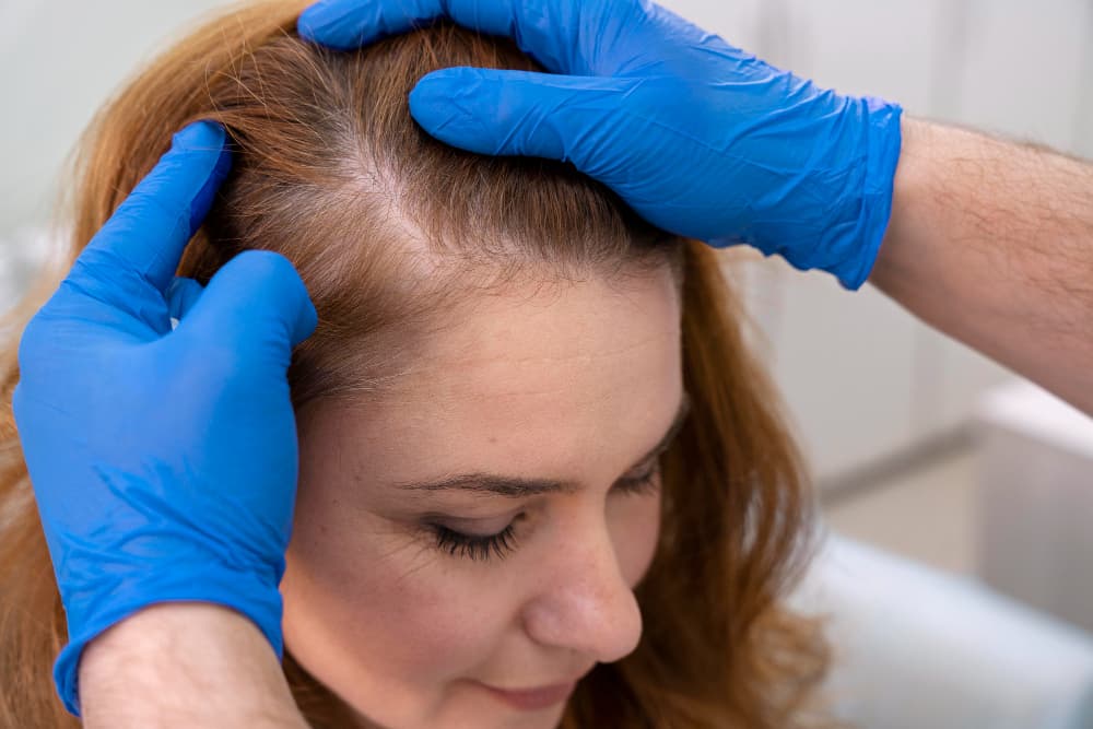 Hair Restoration PRP GFC Exosomes